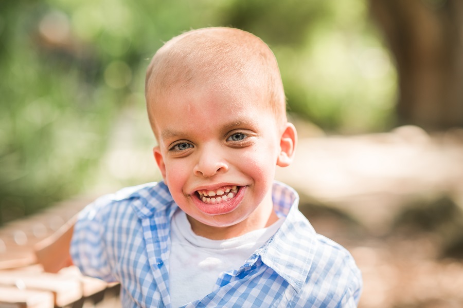 Adan’s Story – Costello Syndrome and Cancer - Children's Cancer ...